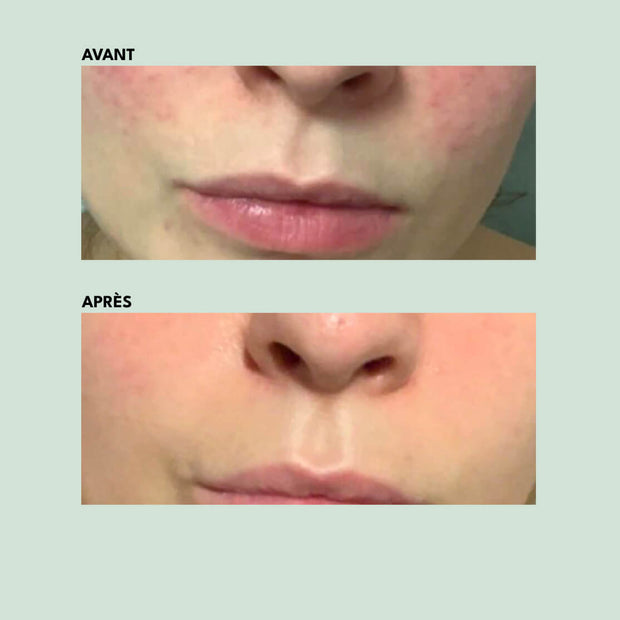 Recharge | Crème Légère