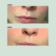 Crème Légère - Anti-Imperfections | 30ml