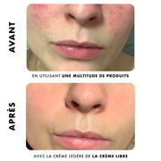 Crème Légère - Anti-Imperfections