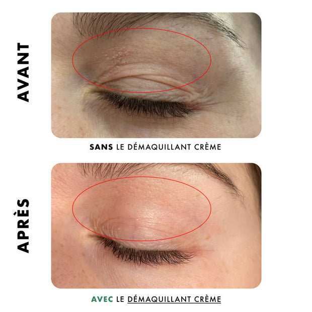 Recharge | Démaquillant Crème