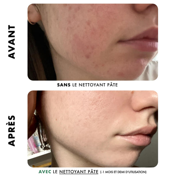 Nettoyant Pâte - Anti-Imperfections